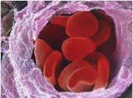 disegno ditrichomoniasi